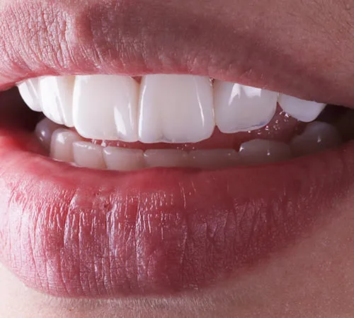 Amostras dentáis | GC Digital Clinic